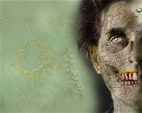 Zombie Outbreak