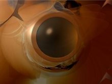 the eye